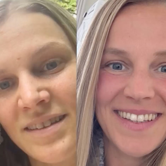 Before & After Healing Journey