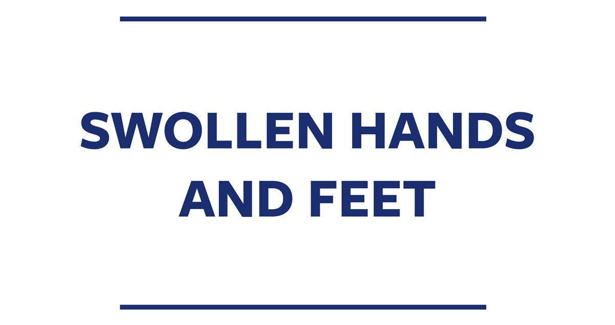 Swollen Hands and Feet