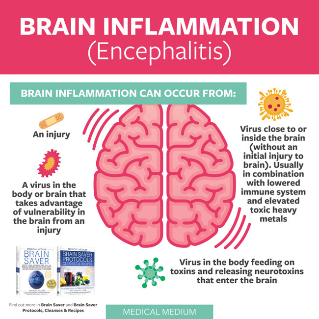 Brain Inflammation (Encephalitis)