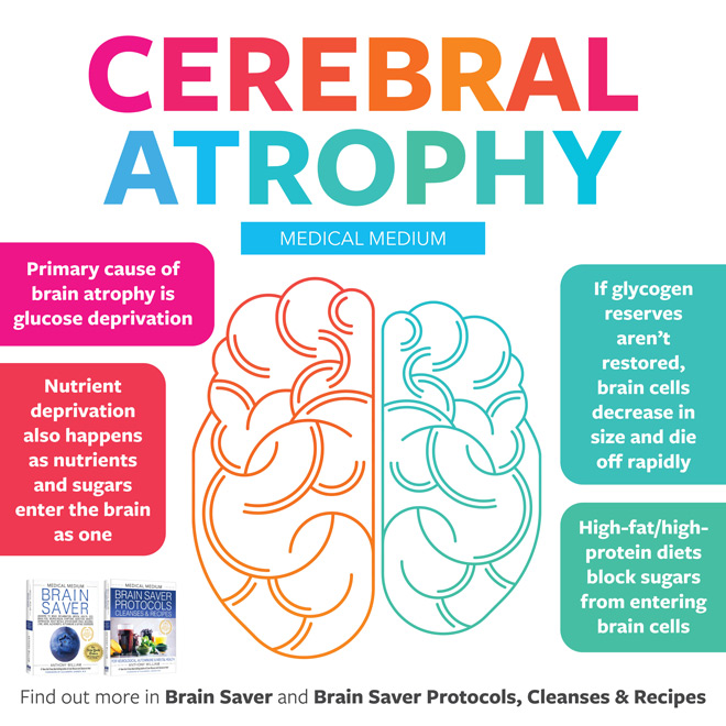 Cerebral Atrophy