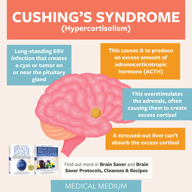 Cushing's Syndrome (Hypercortisolism)