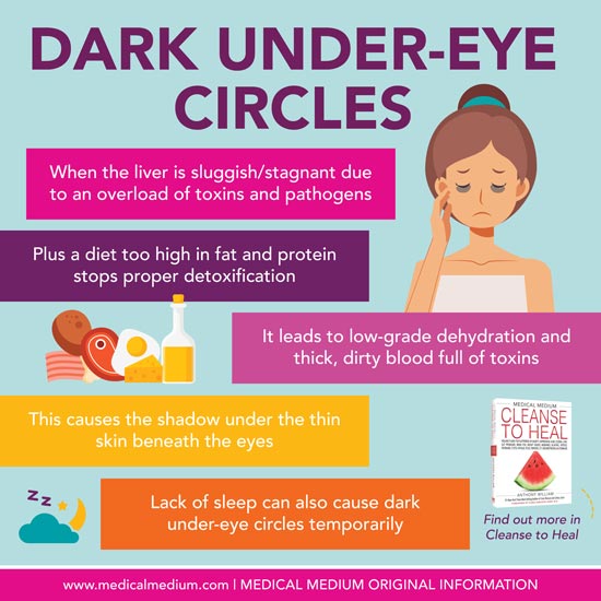 How eating certain foods may get rid of under-eye bags | The Independent |  The Independent