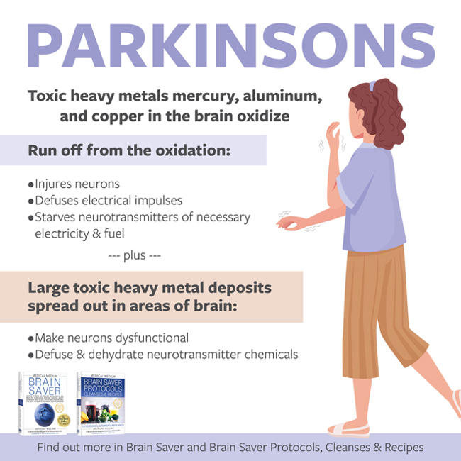 Parkinson's Disease