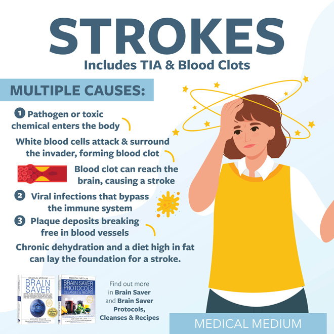 Strokes, Transient Ischemic Attack & Blood Clots
