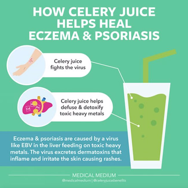 How Celery Juice Helps Heal Eczema & Psoriasis 