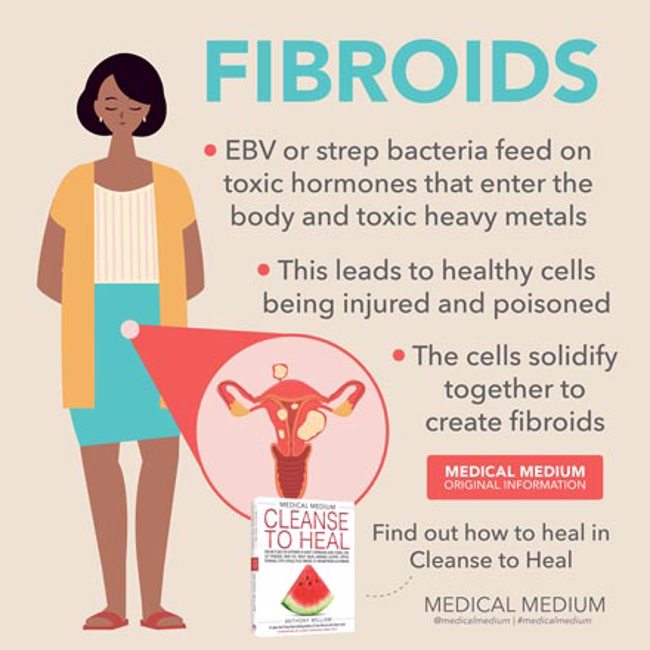 Fibroids