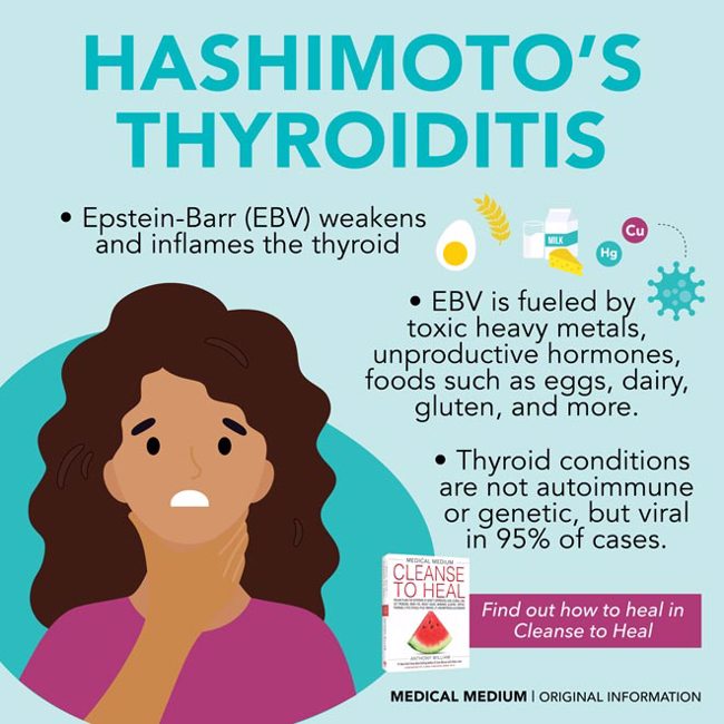 Hashimoto’s Thyroiditis