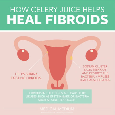 How Celery Juice Helps Heal Fibroids 