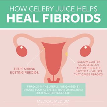 How Celery Juice Helps Heal Fibroids 
