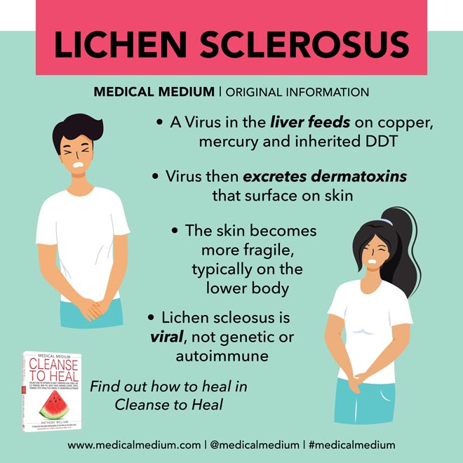 Lichen Sclerosus