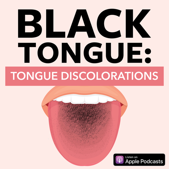 Black Tongue: Tongue Discolorations
