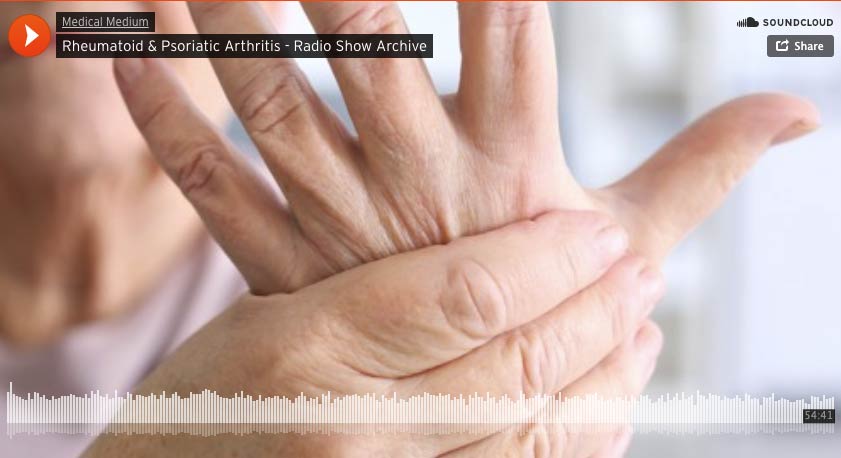 Rheumatoid & Psoriatic Arthritis