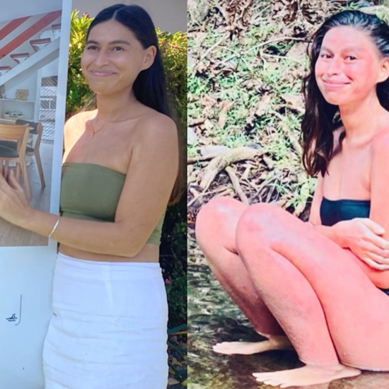 Life-Changing Protocols Healing Eczema