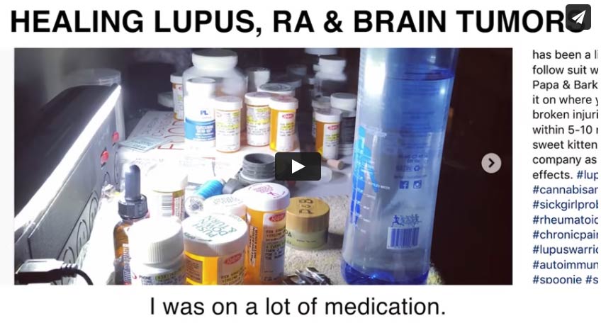 Healing Lupus, RA, Brain Tumors & More with Medical Medium Information