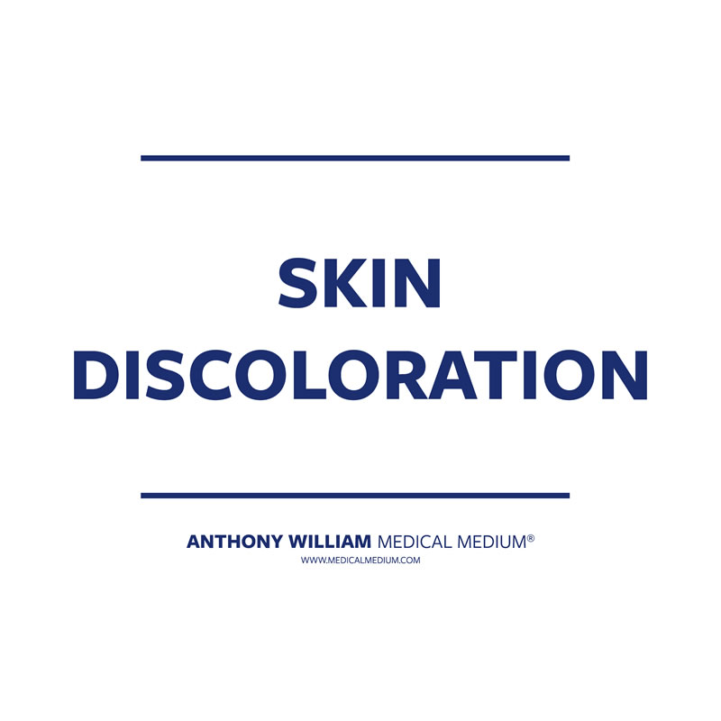 Skin Discoloration 